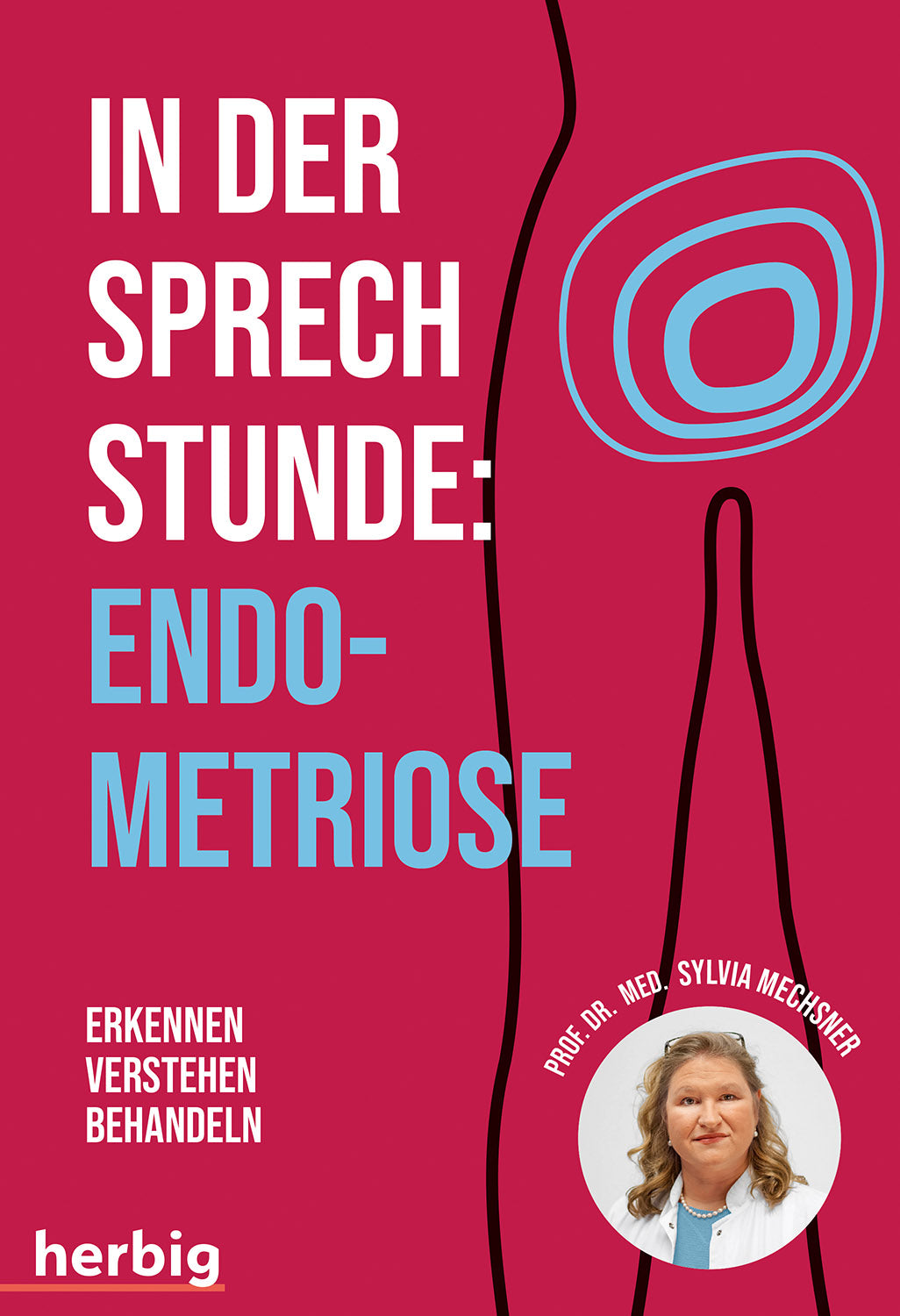 In der Sprechstunde Endometriose