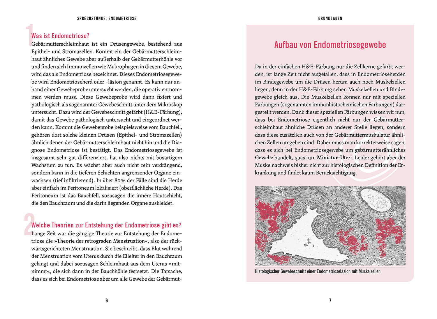 In the Consultation: Endometriosis; Recognize - Understand - Treat