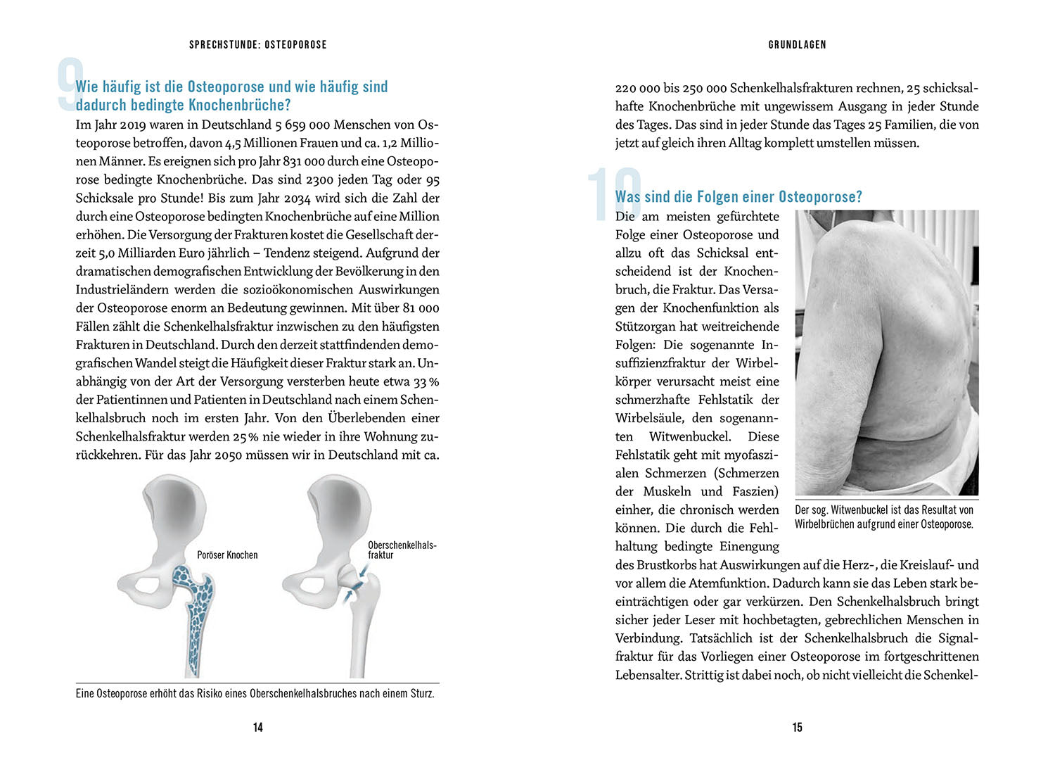 In the Consultation Hour: Osteoporosis