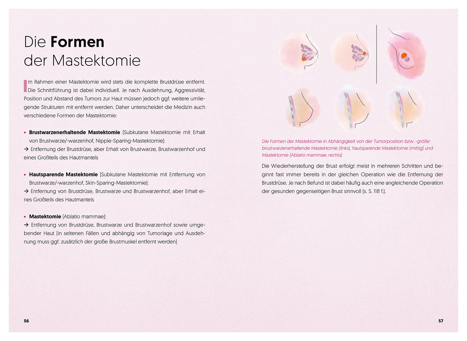 Diagnose Brustkrebs