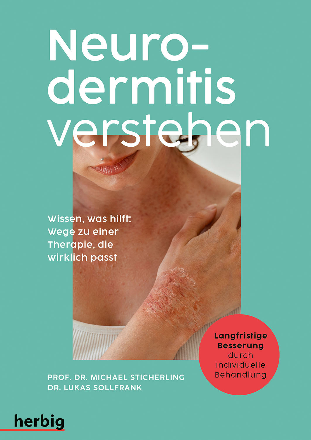 Understanding Atopic Dermatitis