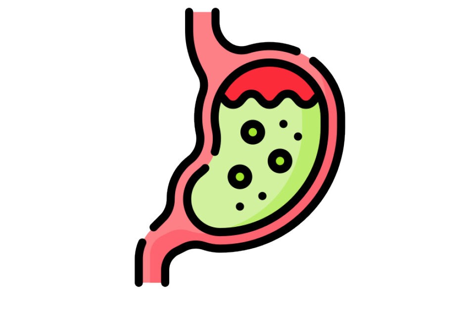 Was ist eigentlich ein Reflux?